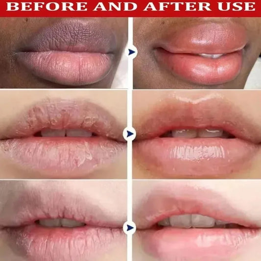 Fast Remove Dark Lip Balm Serum Lighten Melanin Lip Mask Exfoliating Fade Lip Lines Dead Skin Nourishing Repair Lip Care Makeup