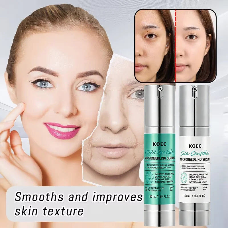 Korean Microneedle Essence Desalination Fine Lines Spots Collagen Solution Reverse Aging Recombinant Improves Rough Texture 50ml