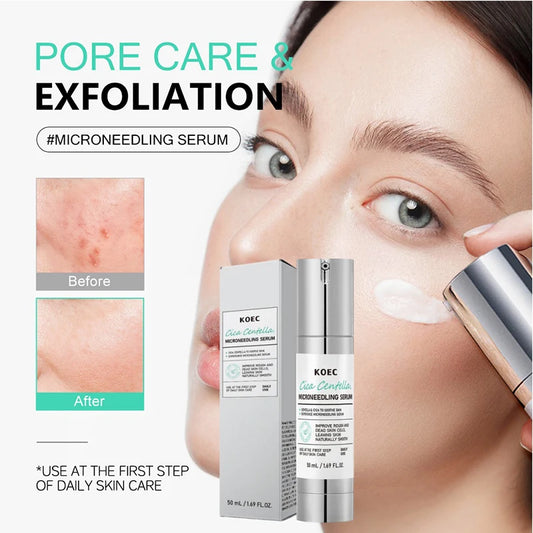 Korean Microneedle Essence Desalination Fine Lines Spots Collagen Solution Reverse Aging Recombinant Improves Rough Texture 50ml