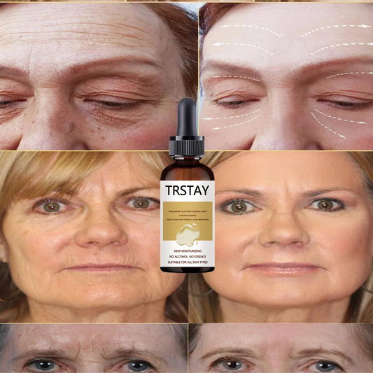 Snail Extract Serum Face Essence Anti Wrinkle Hyaluronic Acid Anti Aging Collagen Whitening Moisturizing Face Care Freeshipping