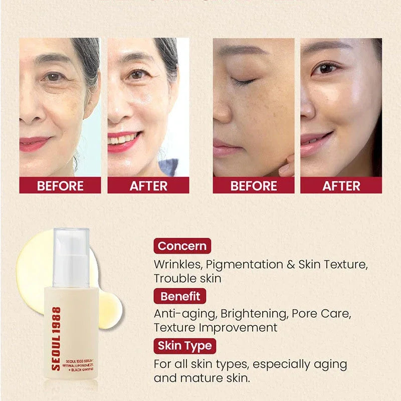 Seoul 1988 100ml Niacinamide 2% Retinal Ginseng Essence Firming Eye Cream Lightens Fine Lines Deep Moisturizing Care Essence Set