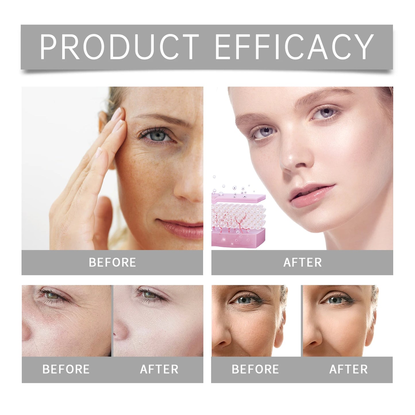 Hyaluronic Acid Essence Skin Care Roller Set Tightening Massage Facial Skin Smoothing Nourishing Improve Rough & Matte Skin